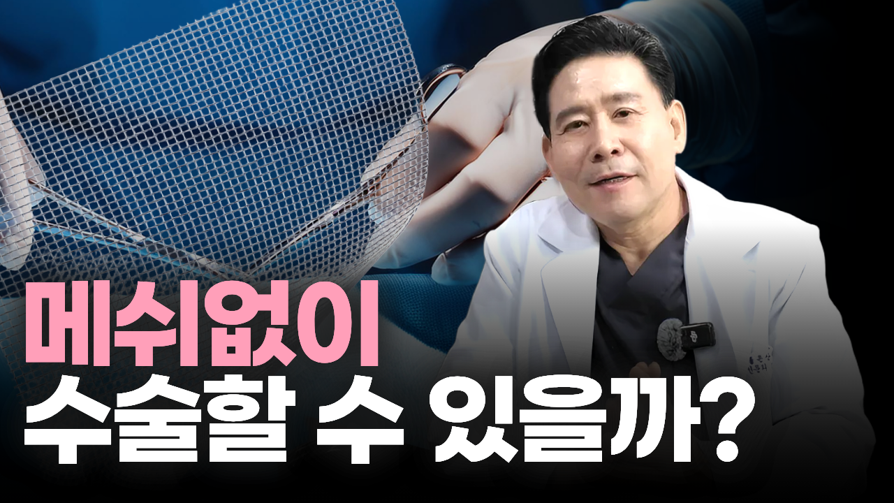 자궁을 올리려고 메쉬를 넣는다? 복강경 수술 전 꼭 알아야 할 것